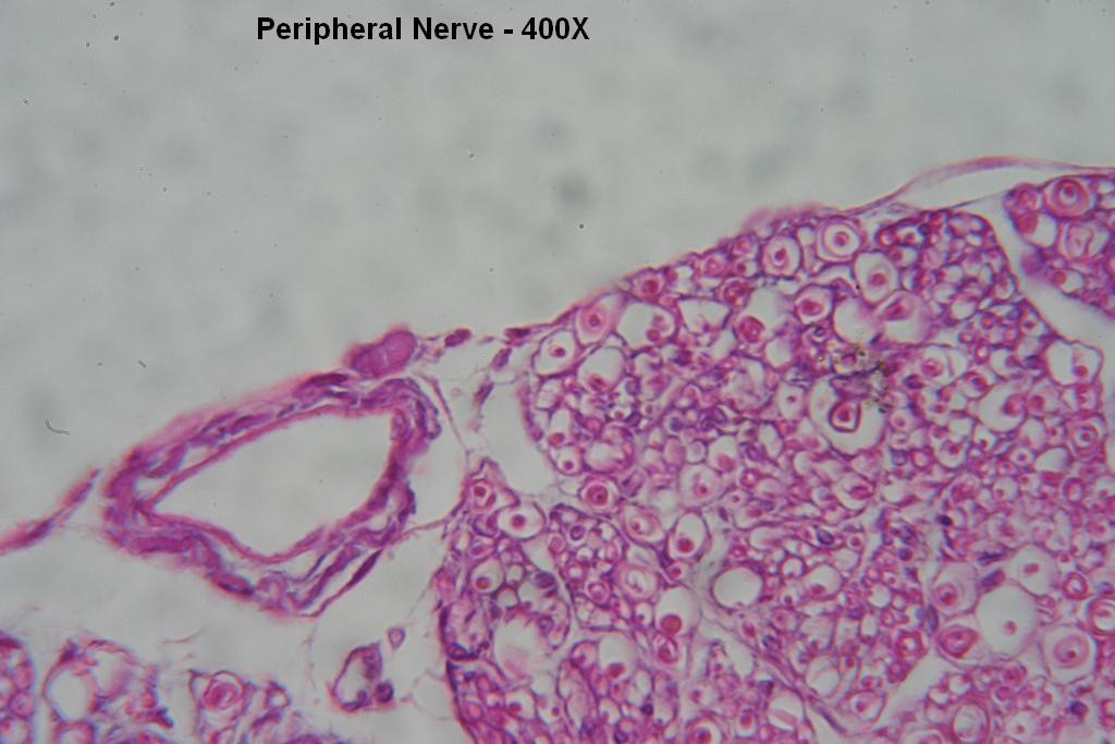 K - Peripheral Nerve 400X - 4