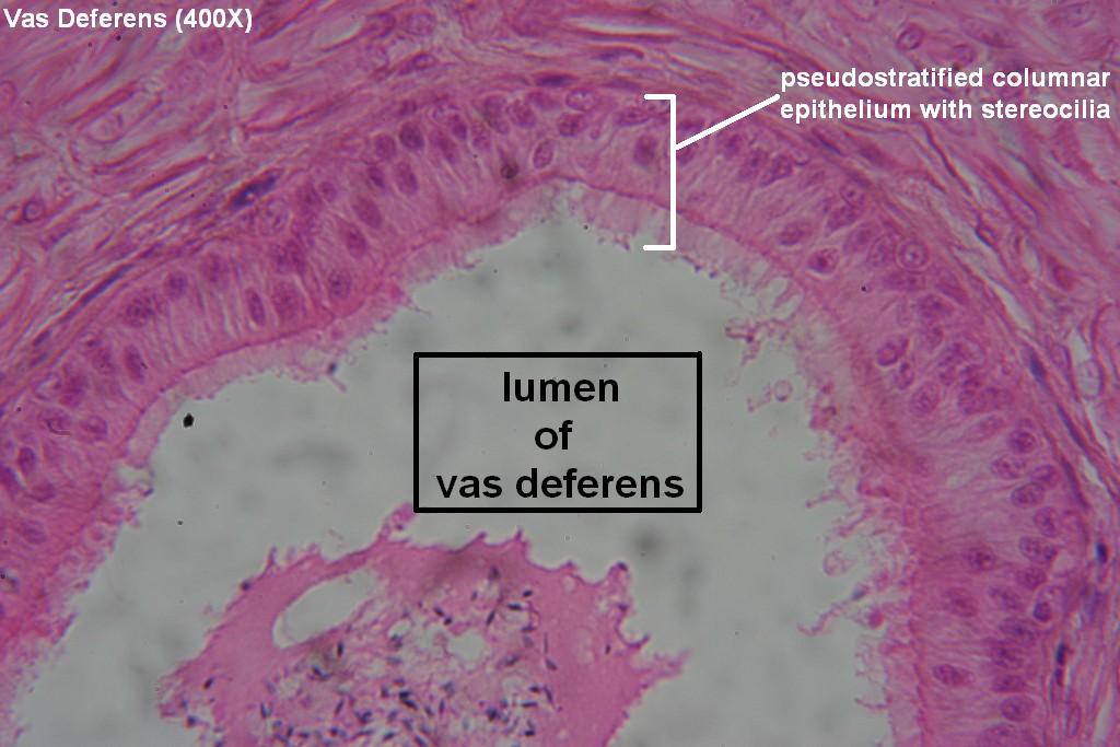 K - Pseudostratified Stereociliated Columnar 400X - 3