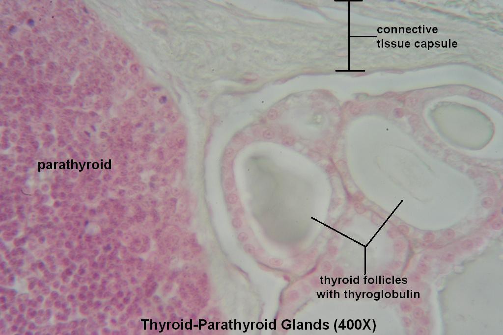 K - Thyroid-Parathyroid 400X - 3