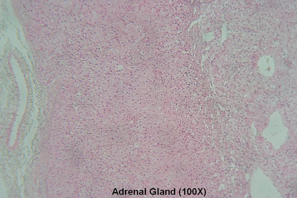 L - Adrenal Gland 100X