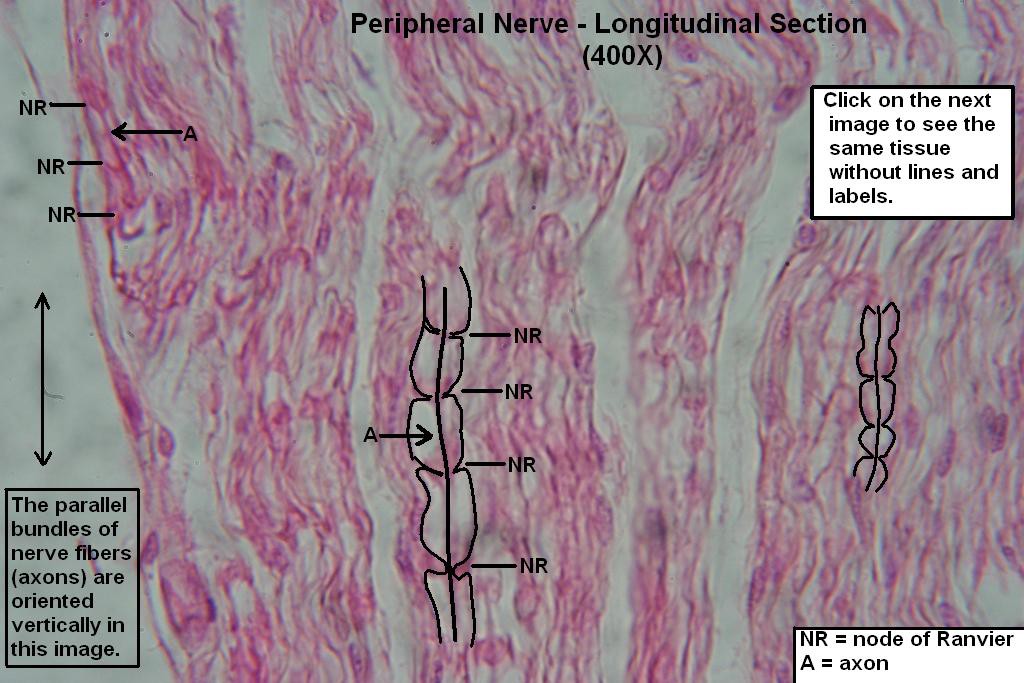 L - Peripheral Nerve - Long Section - Node of Ranvier 400X - 1