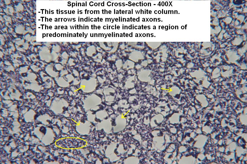 L - Spinal Cord X-Section - White Matter - 400X - 1