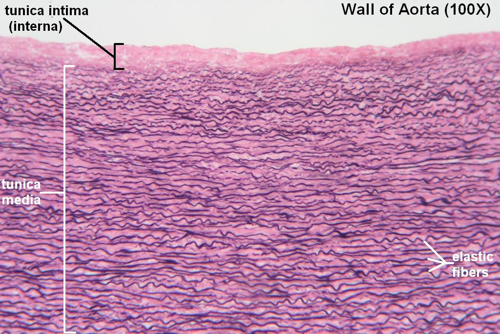 L - Wall of Aorta 100X - 1