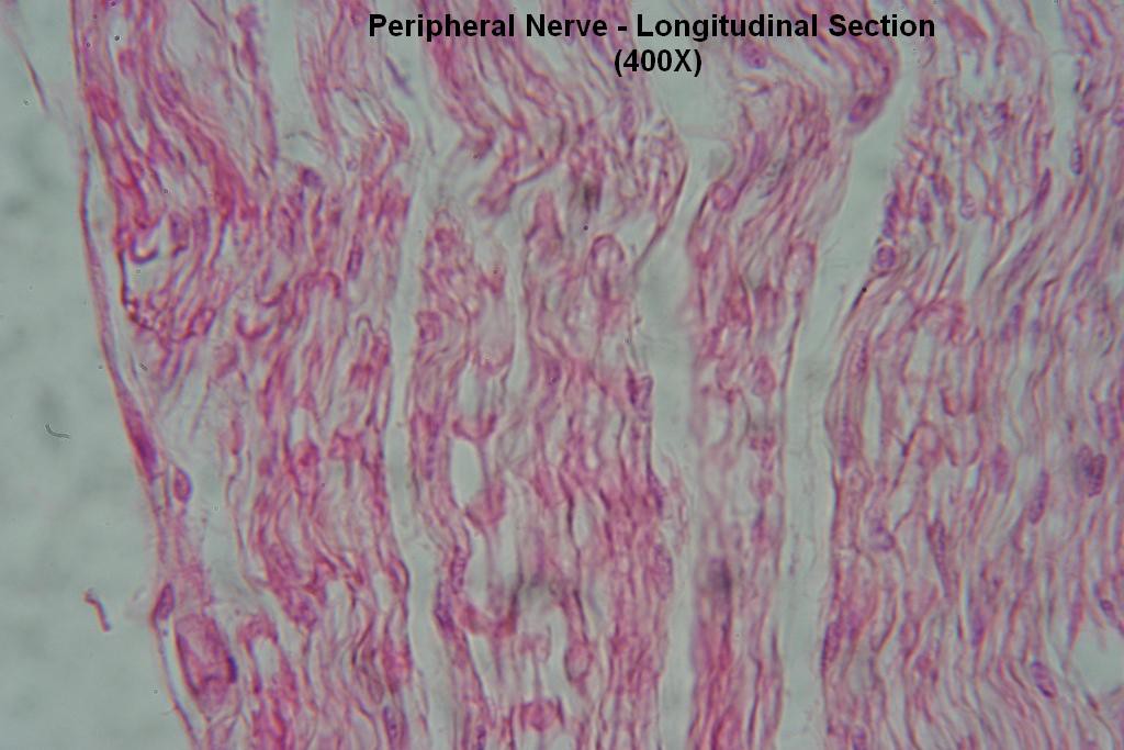 M - Peripheral Nerve - Long Section - Node of Ranvier 400X - 2