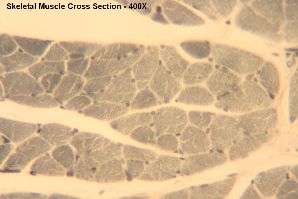 M - Skeletal Muscle X-Section 400X-2