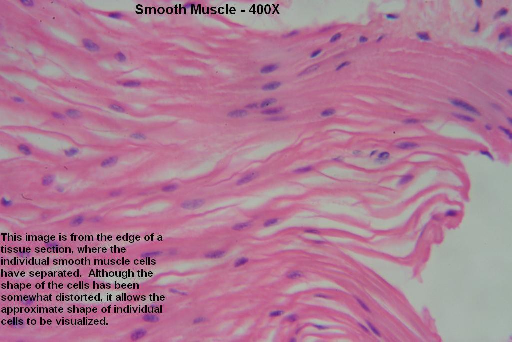 M - Smooth Muscle 400X-7