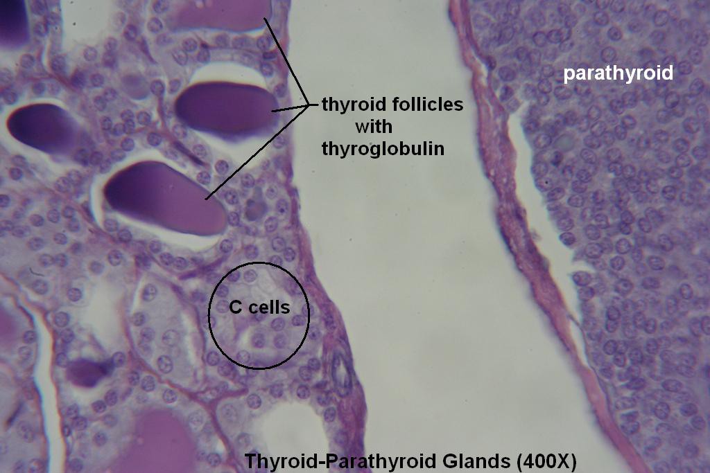 M - Thyroid-Parathyroid 400X - 5