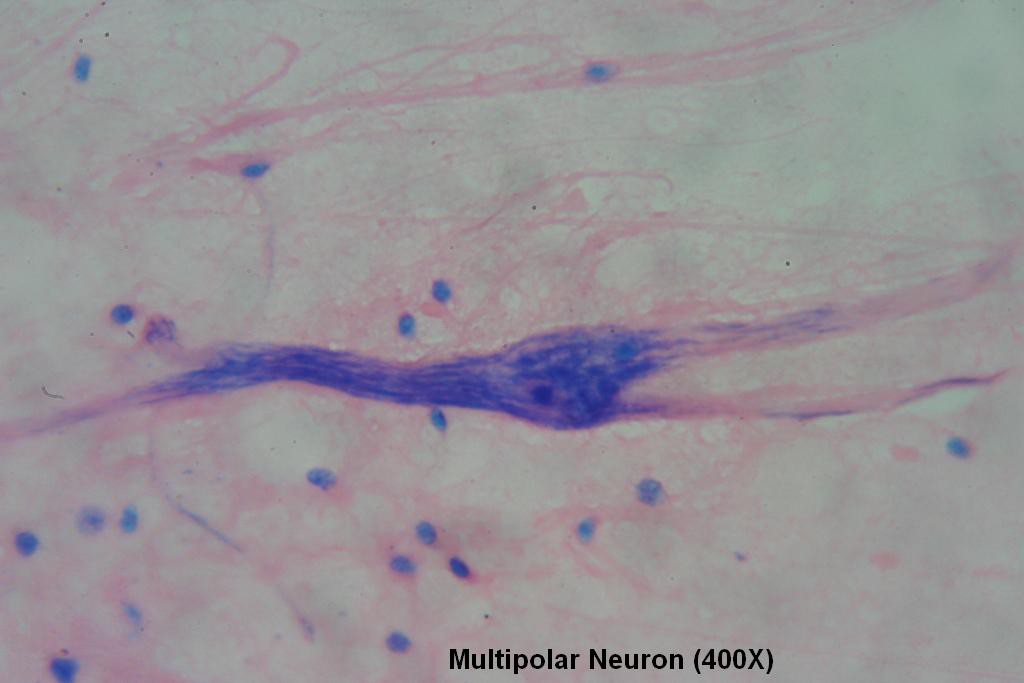 Multipolar Neuron 400X - 1