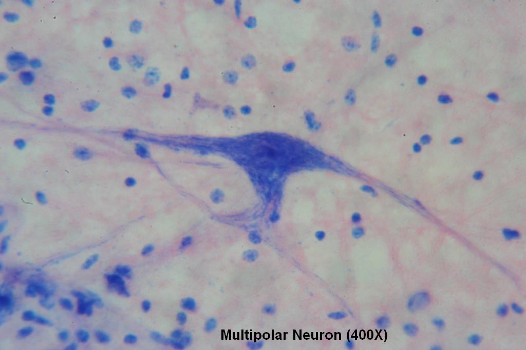 Multipolar Neuron 400X - 2