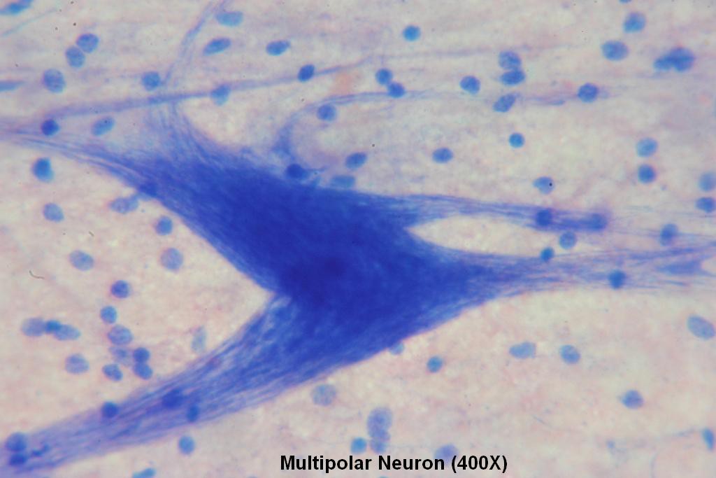 Multipolar Neuron 400X - 4
