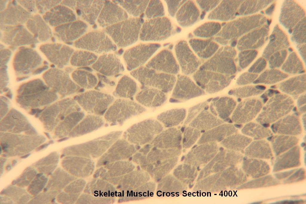 N - Skeletal Muscle X-Section 400X-3