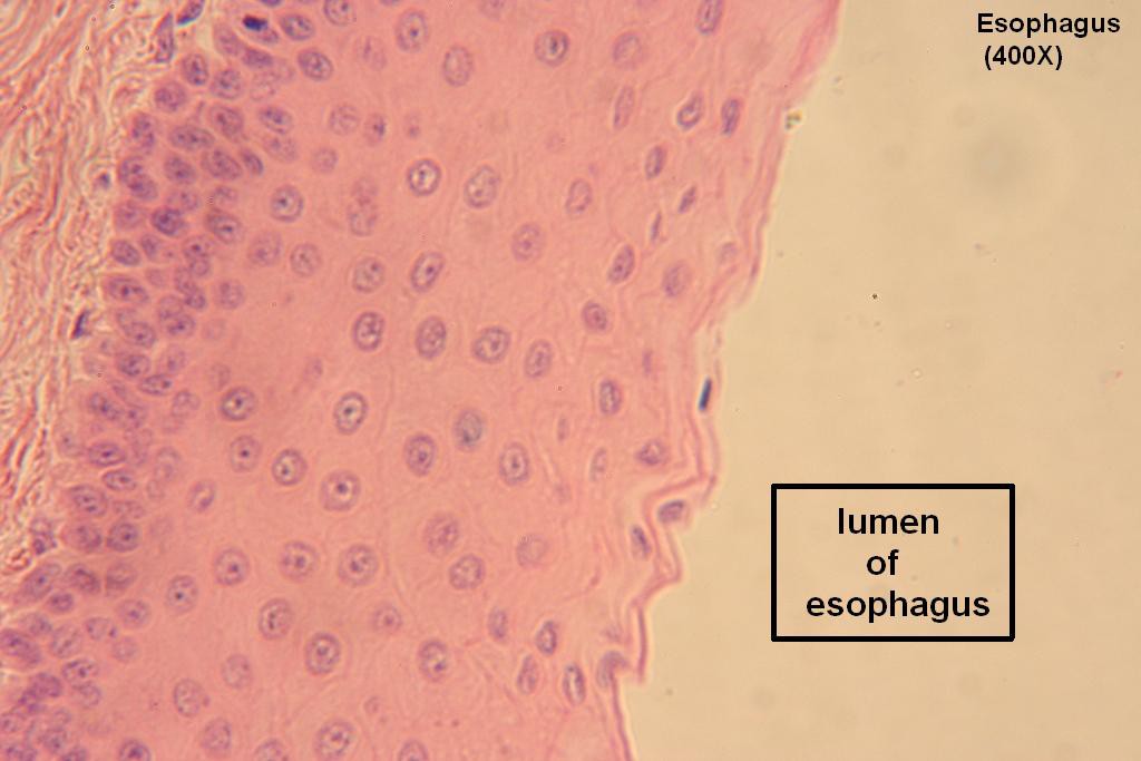 N - Stratified Squamous 400X - 4