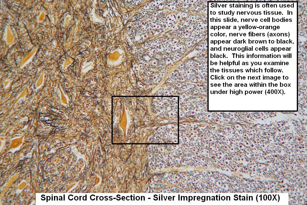 O - Spinal Cord - Silver Stain 100X - 1