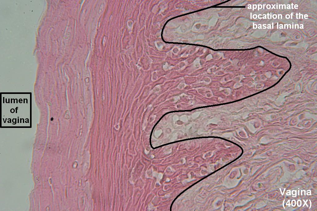 O - Stratified Squamous 400X - 5