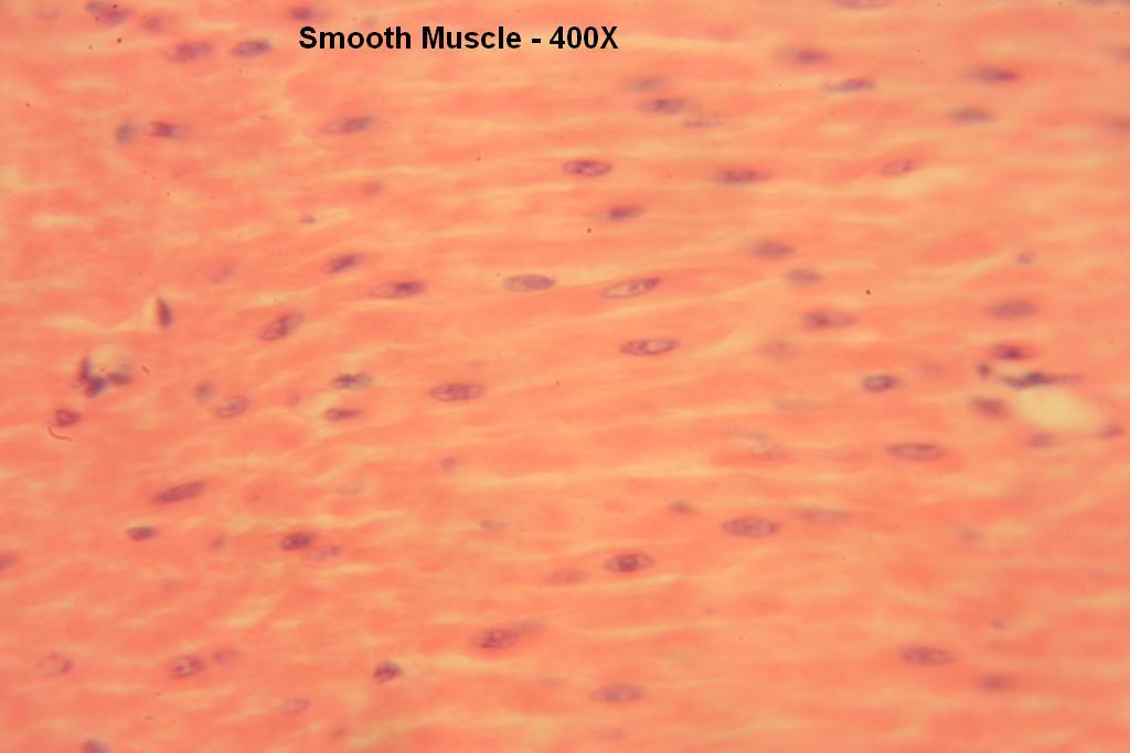 P - Smooth Muscle 400X-10