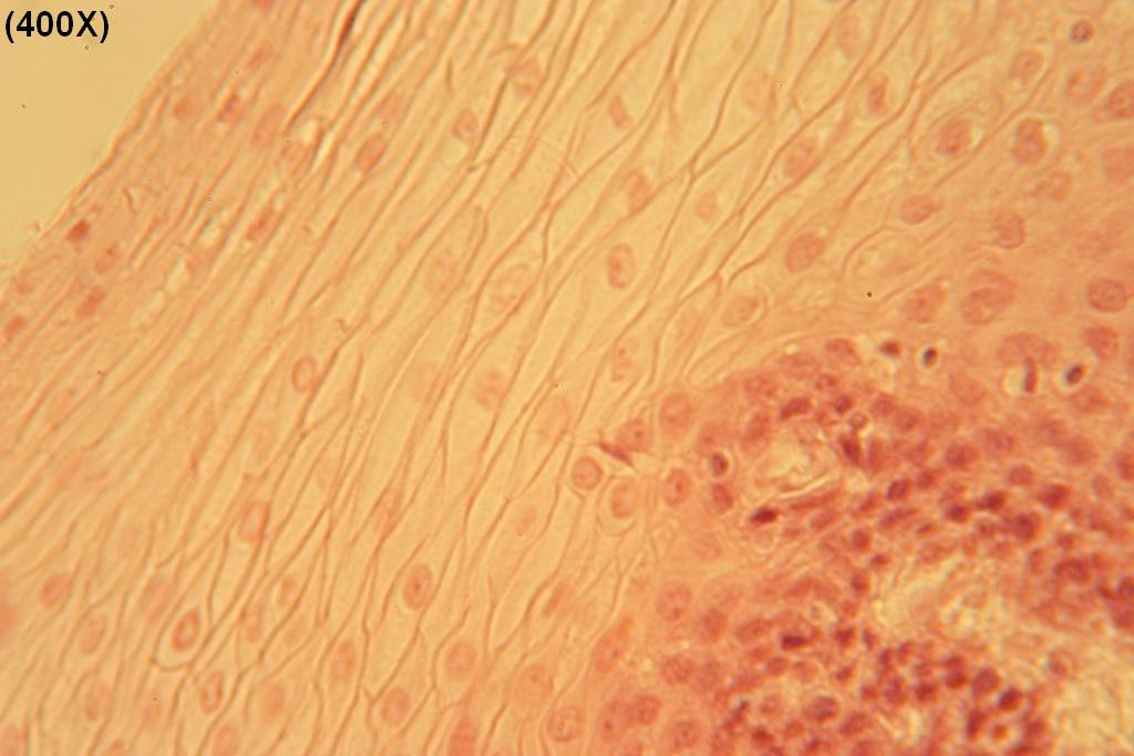P - Stratified Squamous 400X - 6