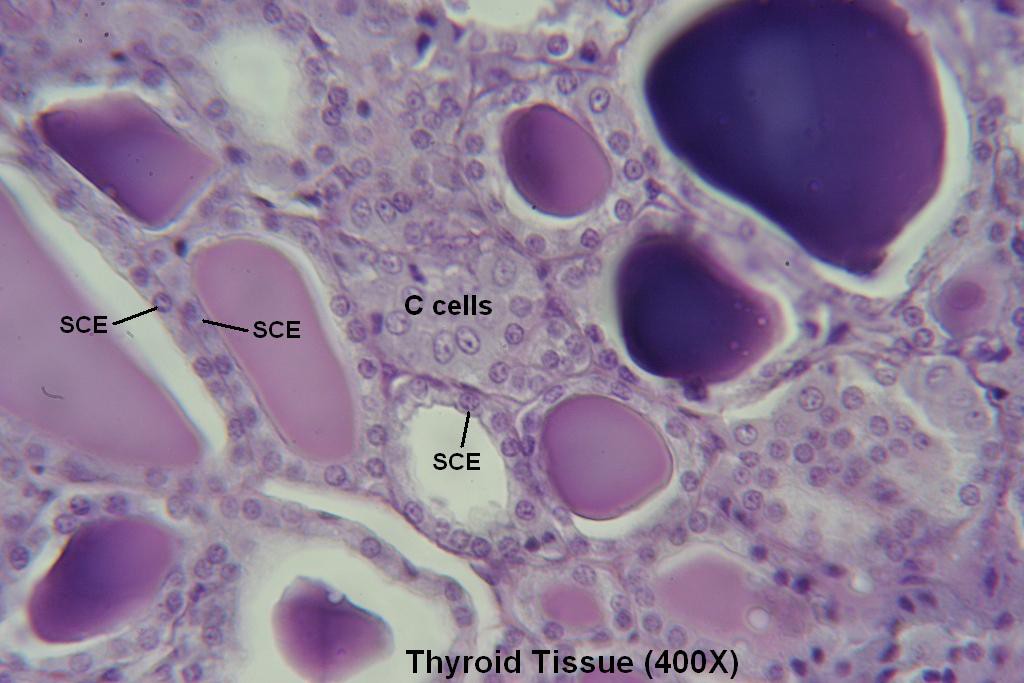 P - Thyroid-Tissue 400X - 3