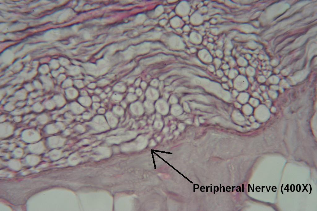 Q - Peripheral Nerve 400X