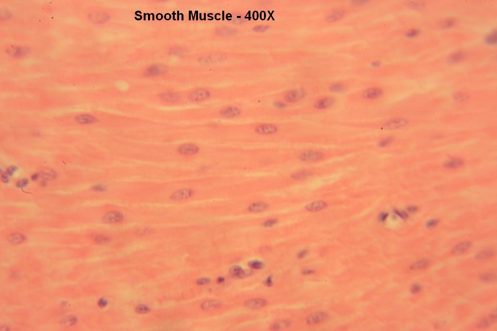 Q - Smooth Muscle 400X-11