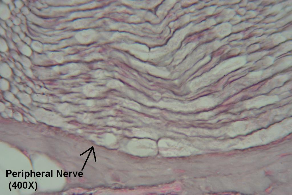 R - Peripheral Nerve 400X