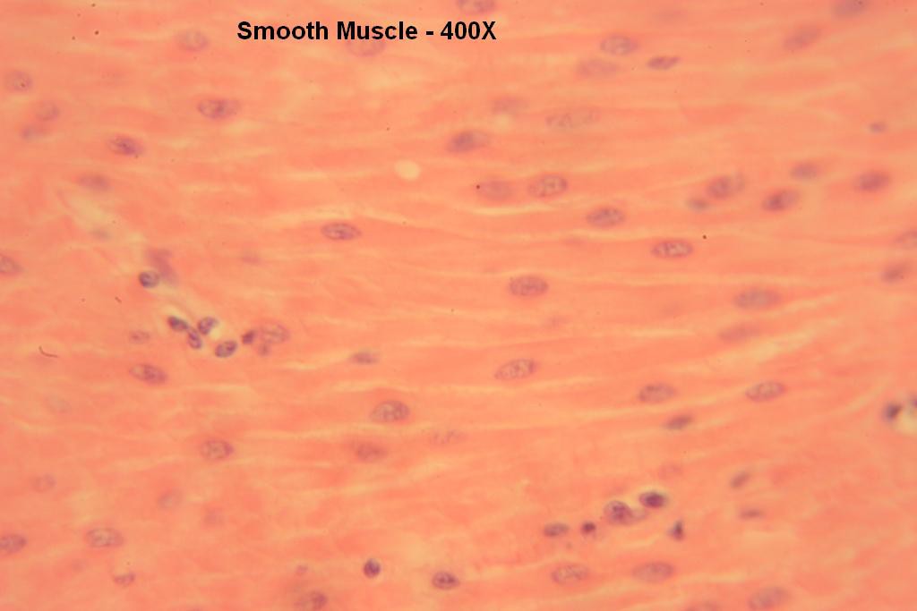 R - Smooth Muscle 400X-12