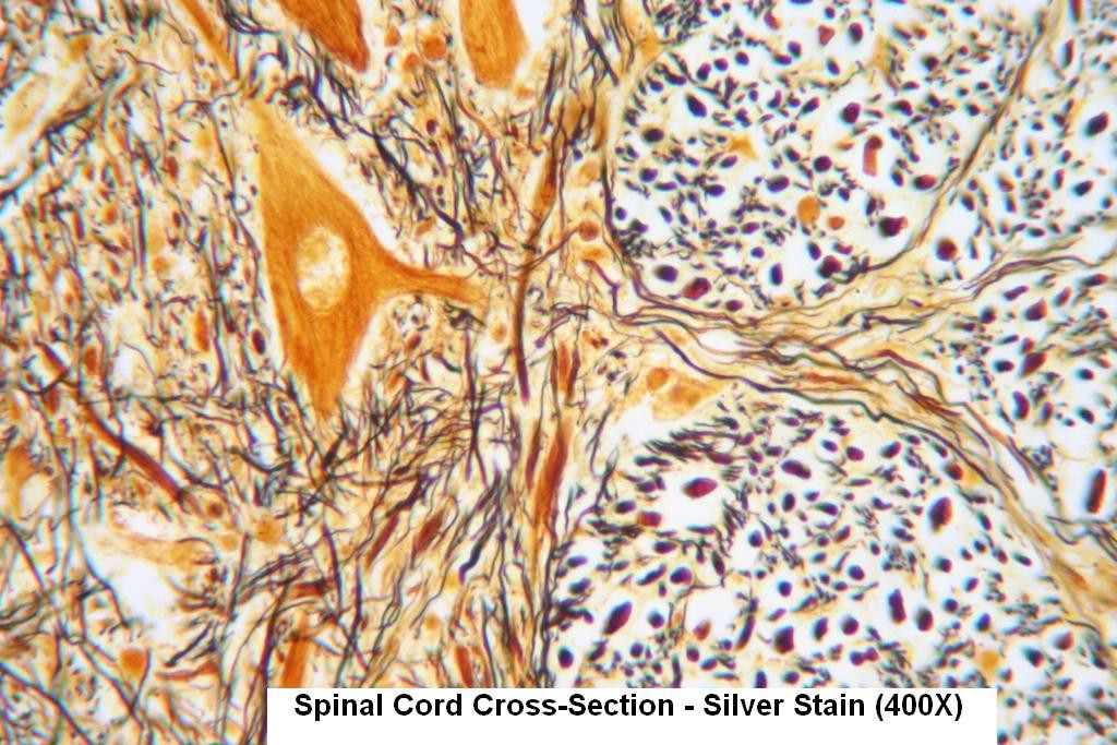 R - Spinal Cord - Silver Stain 400X - 3