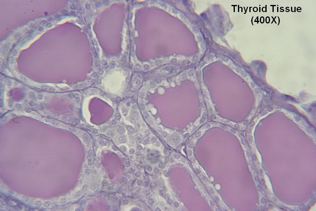 R - Thyroid-Tissue 400X - 5