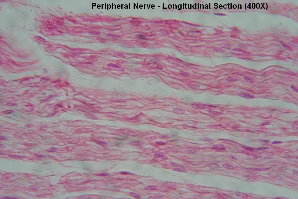 S - Peripheral Nerve - Long Section - Node of Ranvier 400X - 4