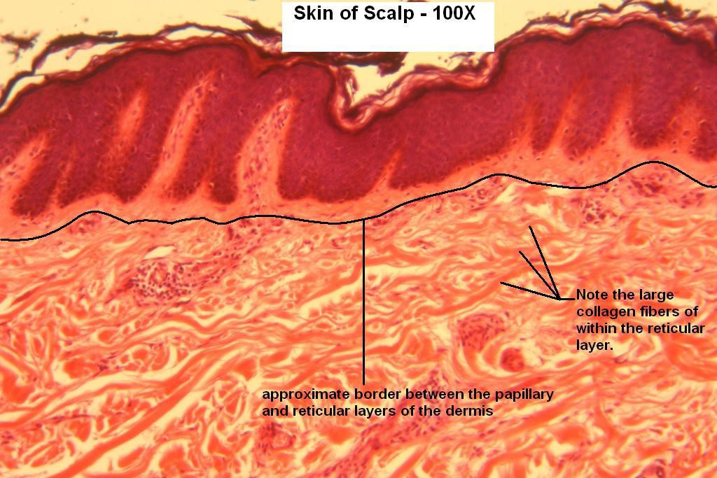 S - Scalp 100X-6-Layers of Dermis
