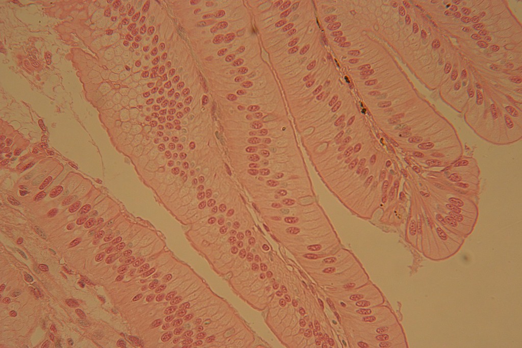 Simple Columnar 100X - 1