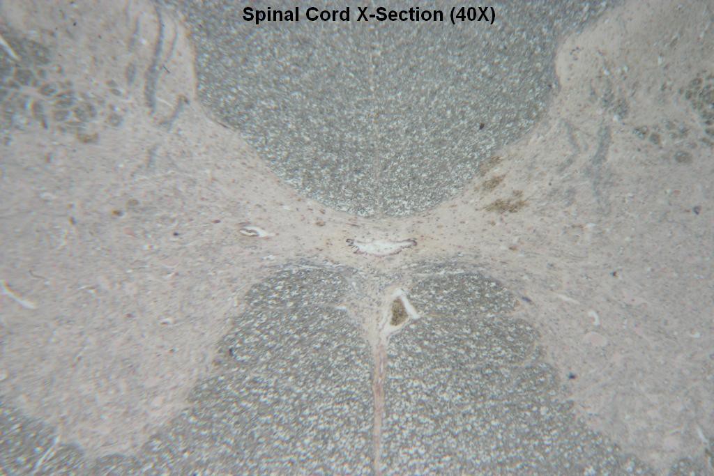 Spinal Cord X-Section 40X - 1