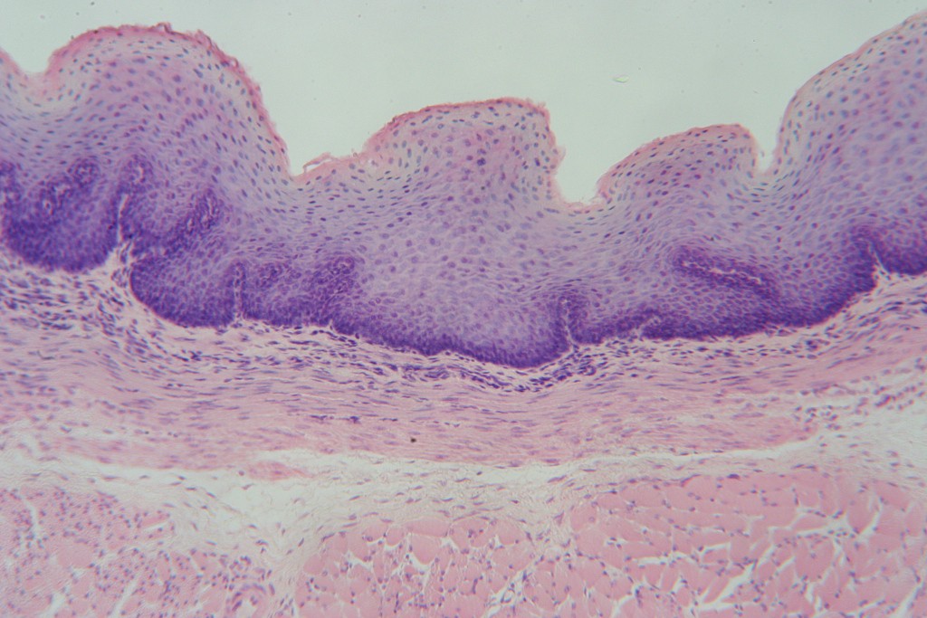 Stratified Squamous 100X - 1
