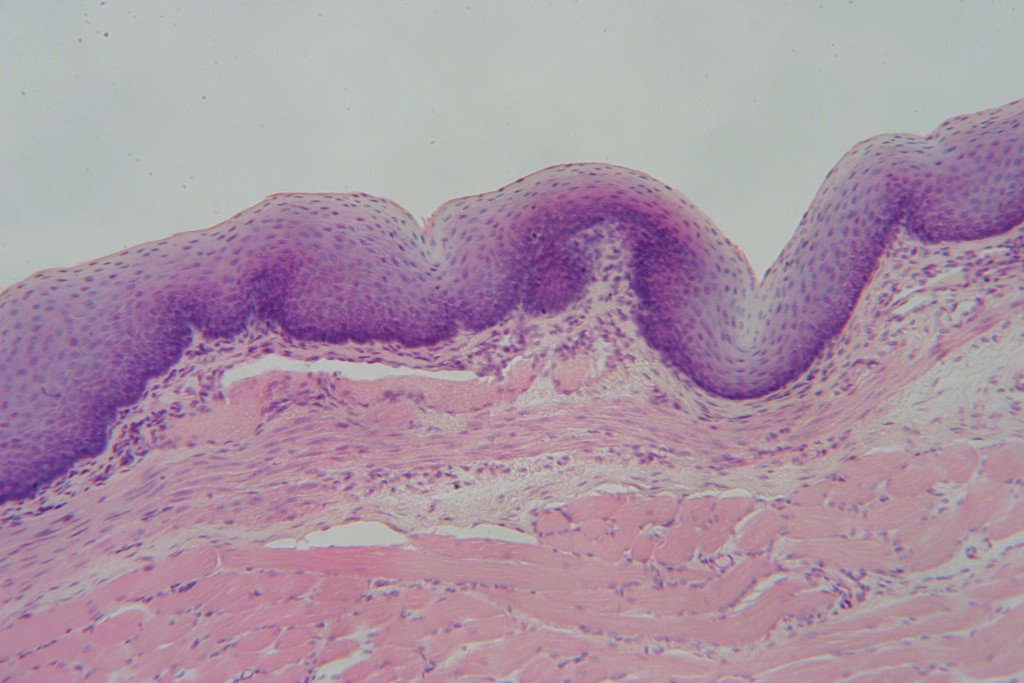 Stratified Squamous 100X - 2