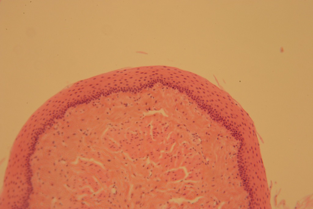 Stratified Squamous 100X - 5