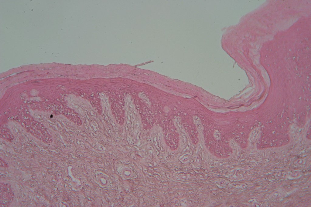 Stratified Squamous 100X - 7
