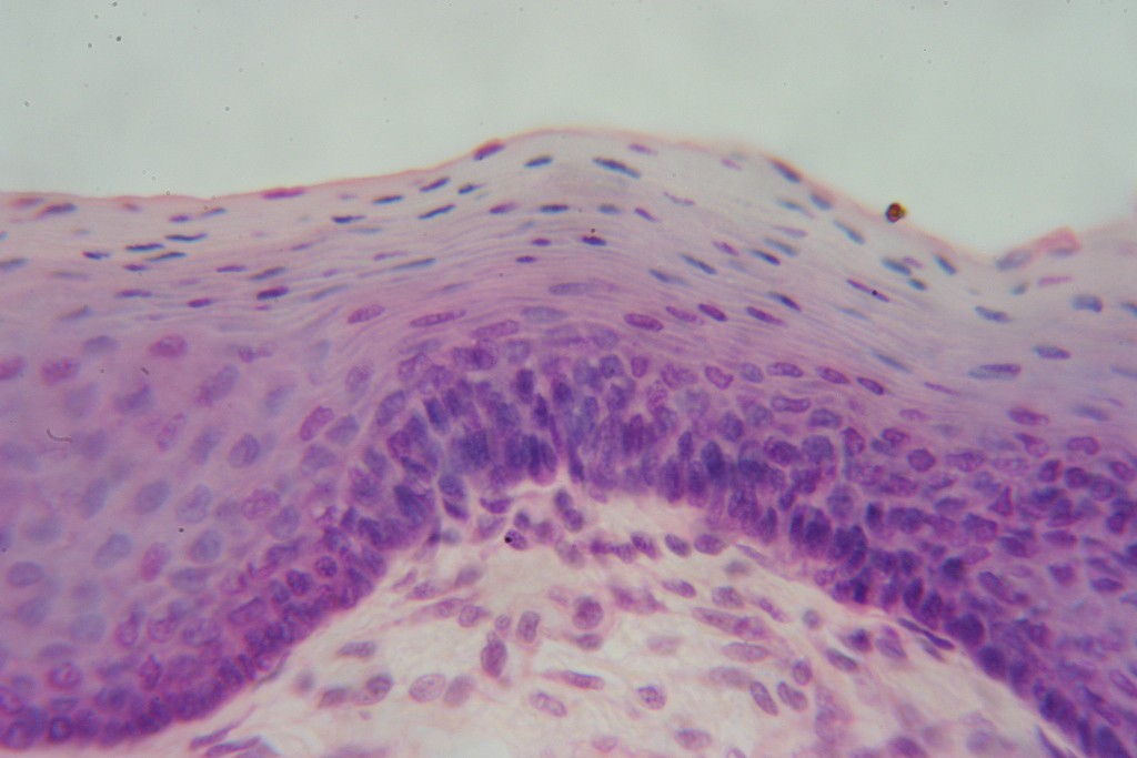 Stratified Squamous 400X - 1
