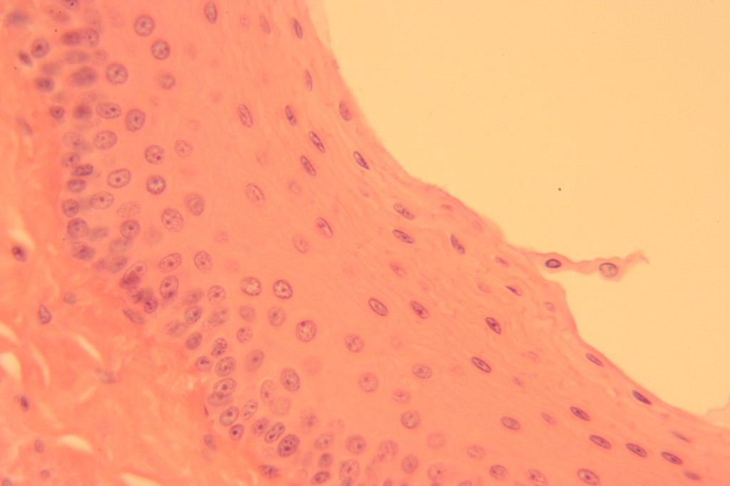 Stratified Squamous 400X - 5