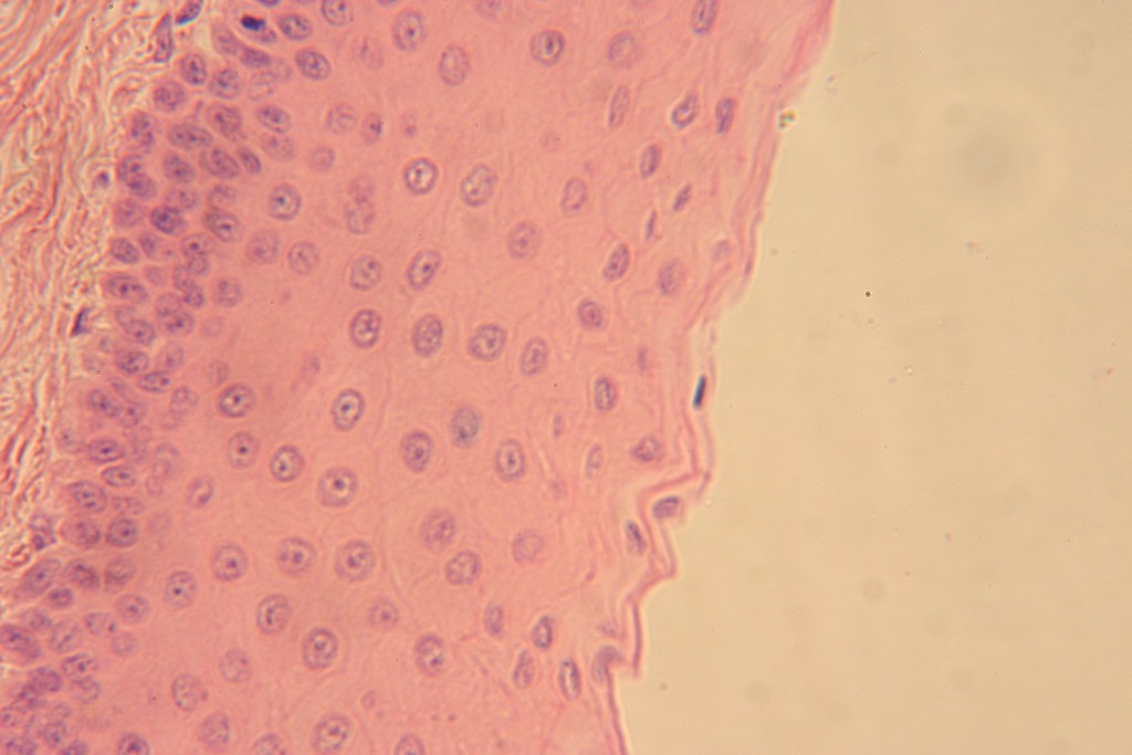Stratified Squamous 400X - 6