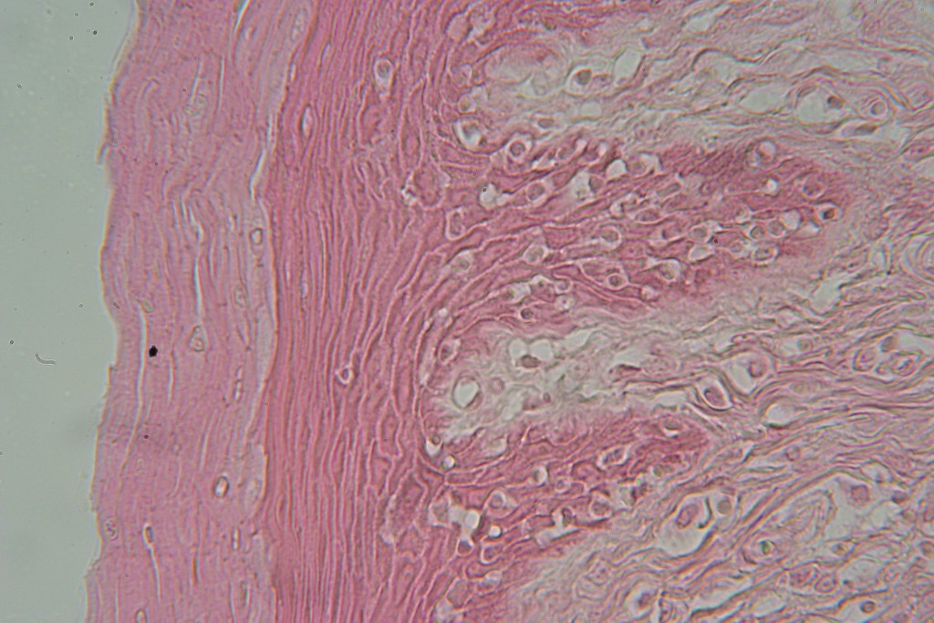 Stratified Squamous 400X - 7