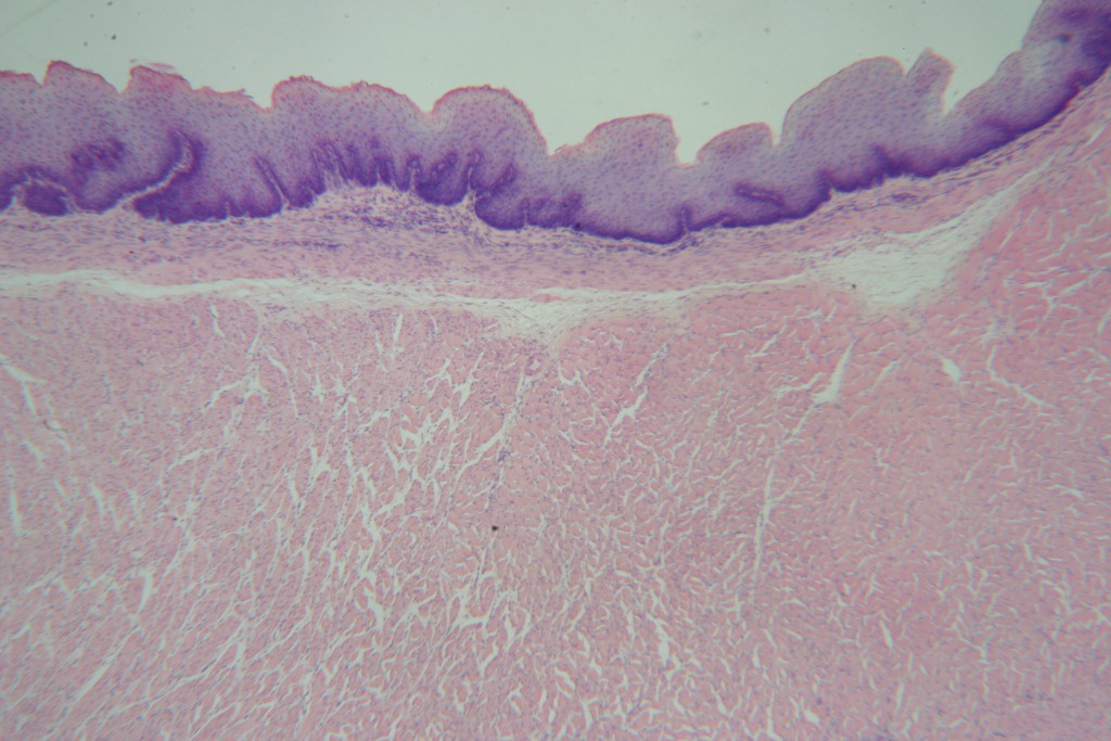 Stratified Squamous 40X - 1