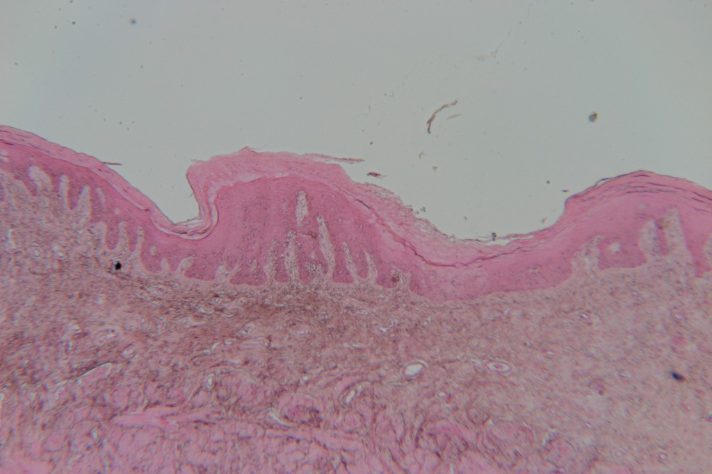 Stratified Squamous 40X - 2