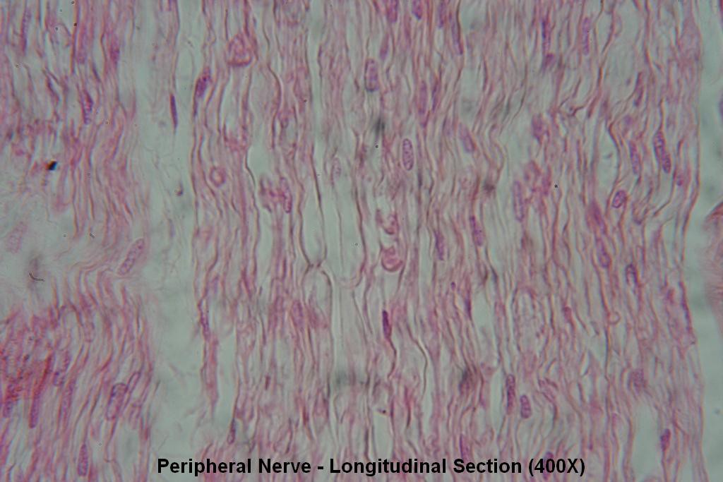 T - Peripheral Nerve - Long Section - Node of Ranvier 400X - 5