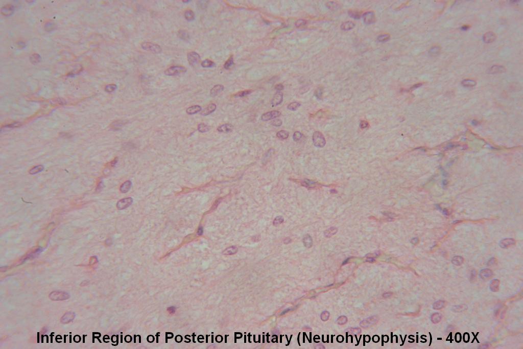W - Pituitary Gland 400X - Posterior Pit - 2