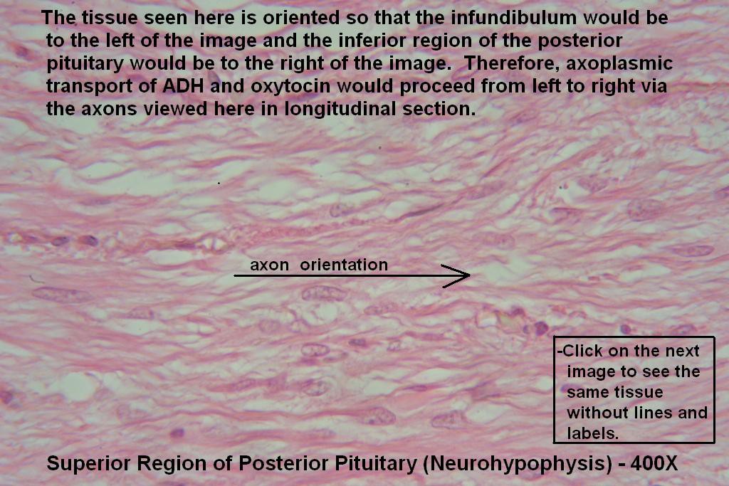 Y - Pituitary Gland 400X - Posterior Pit - 4