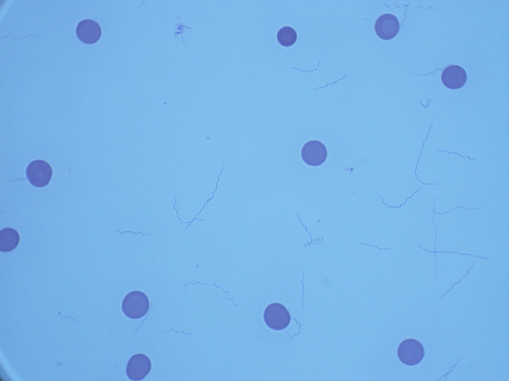 Borrelia burgdorferi 1000X - F