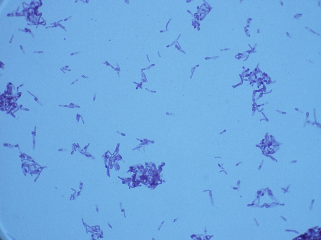 Clostridium tetani 1000X - L