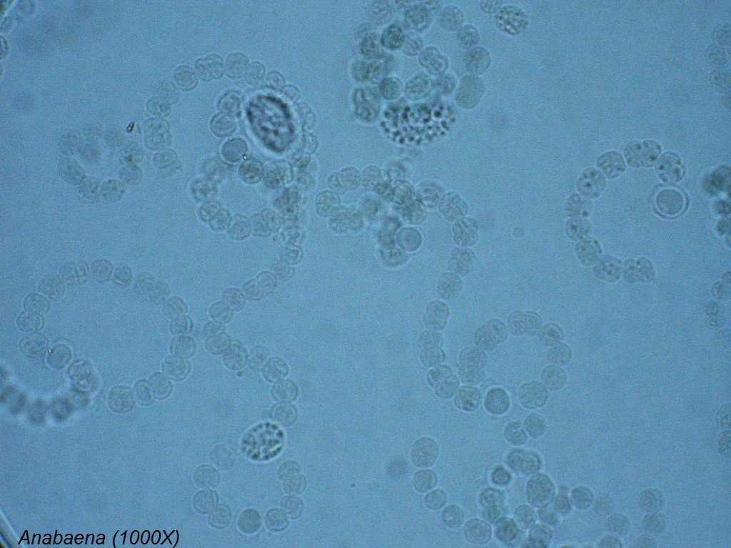 G - Anabaena 1000X - 2