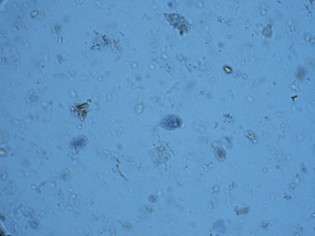 Giardia 1000X - 1Q