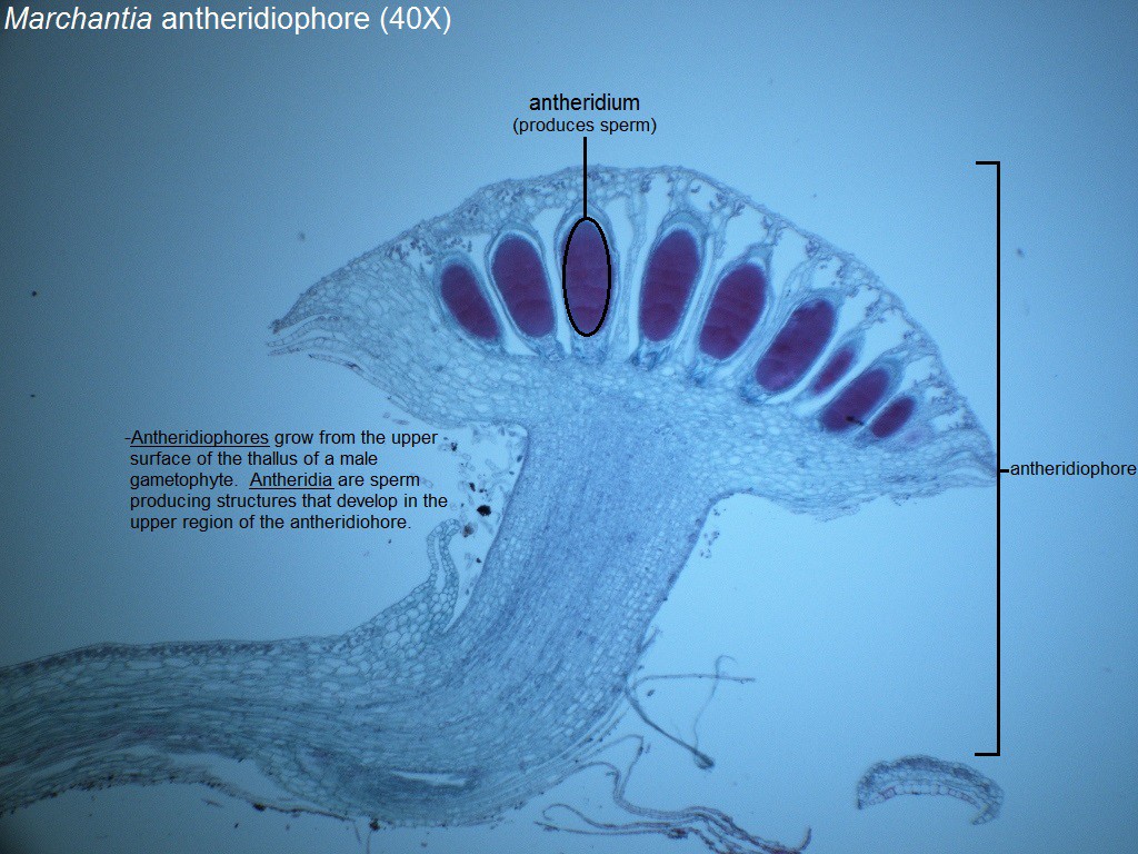 H - Marchantia antheridia 40X