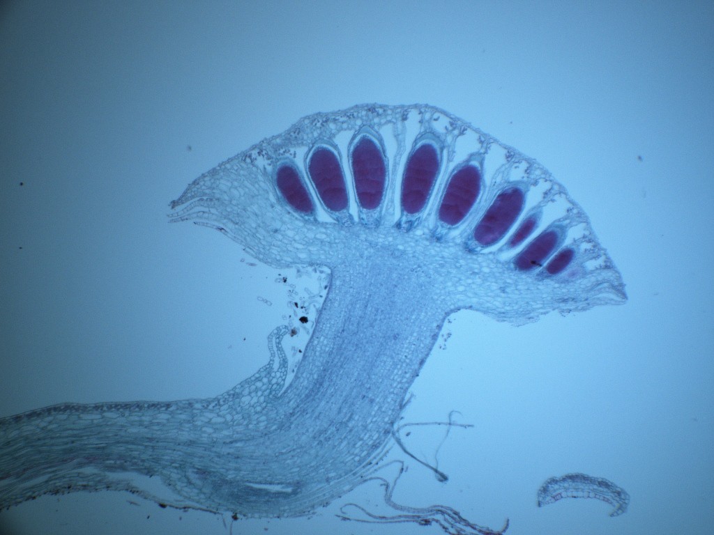 Marchantia antheridia 40X - H